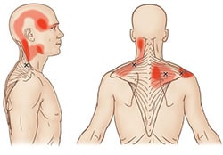 Baş Ağrısı ve Migren Tedavisi